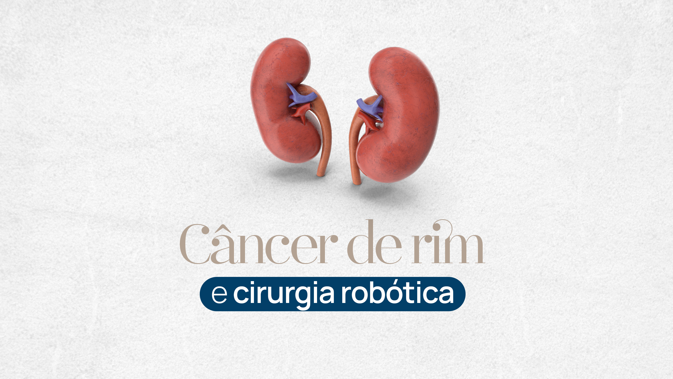 Câncer de rim é silencioso, mas tem altas chances de cura quando detectado cedo. Veja como a cirurgia robótica ajuda.