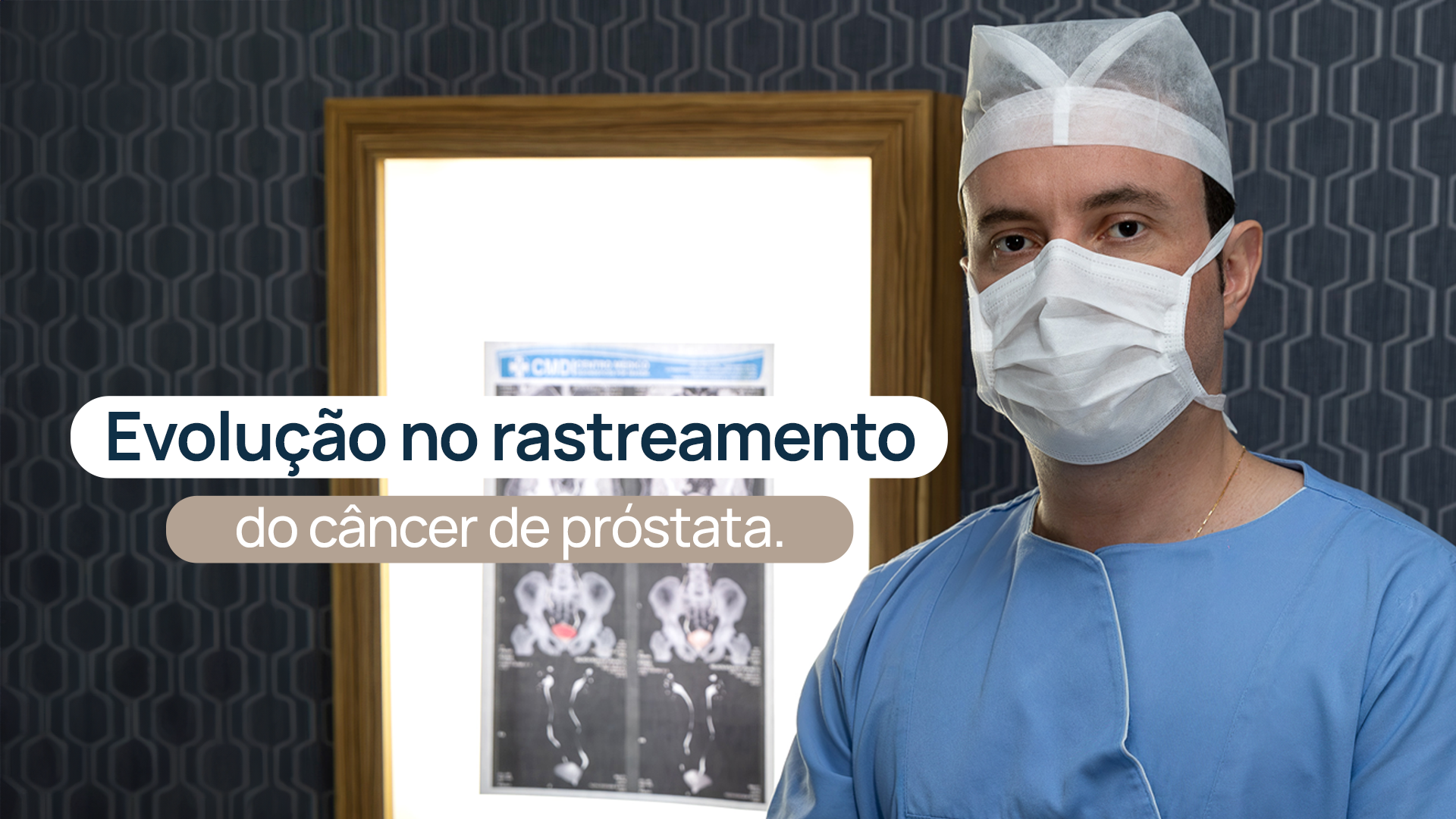 O rastreamento do câncer de próstata evoluiu. Conheça o papel da ressonância multiparamétrica no diagnóstico precoce e seguro.